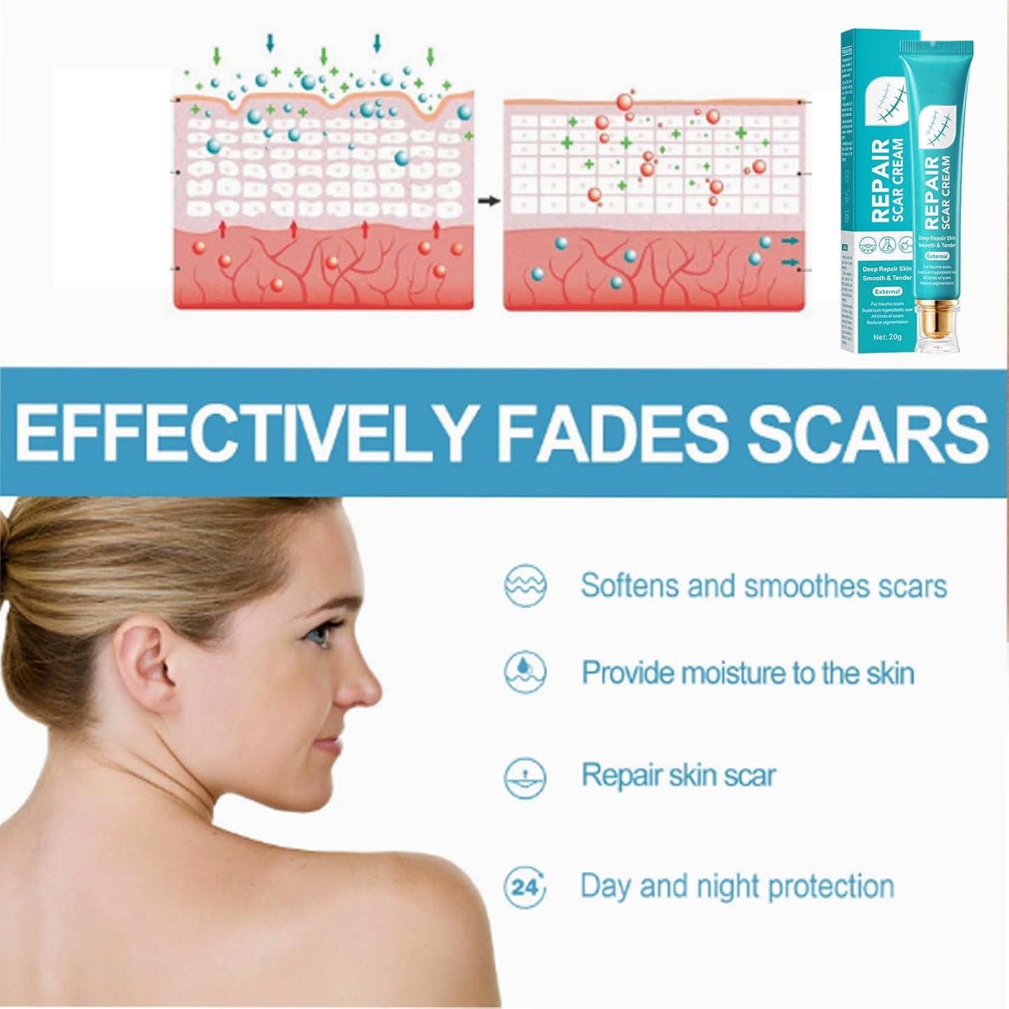 ¡Piel Perfecta! Elimina Cicatrices, Estrías y Marcas con REPAIR SCAR CREAM