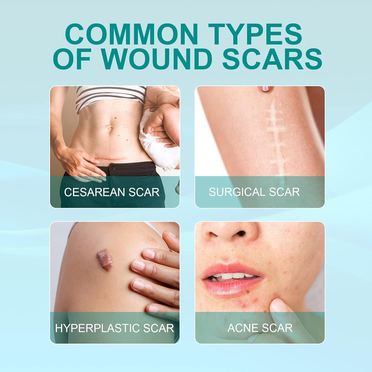 ¡Borra Cicatrices y Marcas para Siempre! Recupera una Piel Lisa y Uniforme sin Cirugías 🚫💉✨