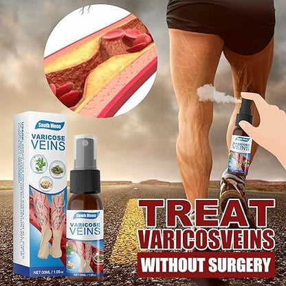 Spray natural para venas varicosas, 30 ml. SUPER OFERTA 2x1, tratamiento para venas varicosas en piernas, mejora la circulación en las piernas.