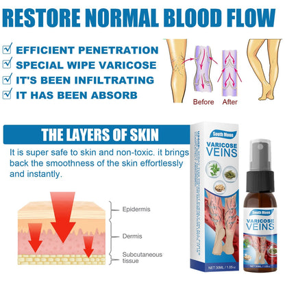 Spray natural para venas varicosas, 30 ml. SUPER OFERTA 2x1, tratamiento para venas varicosas en piernas, mejora la circulación en las piernas.