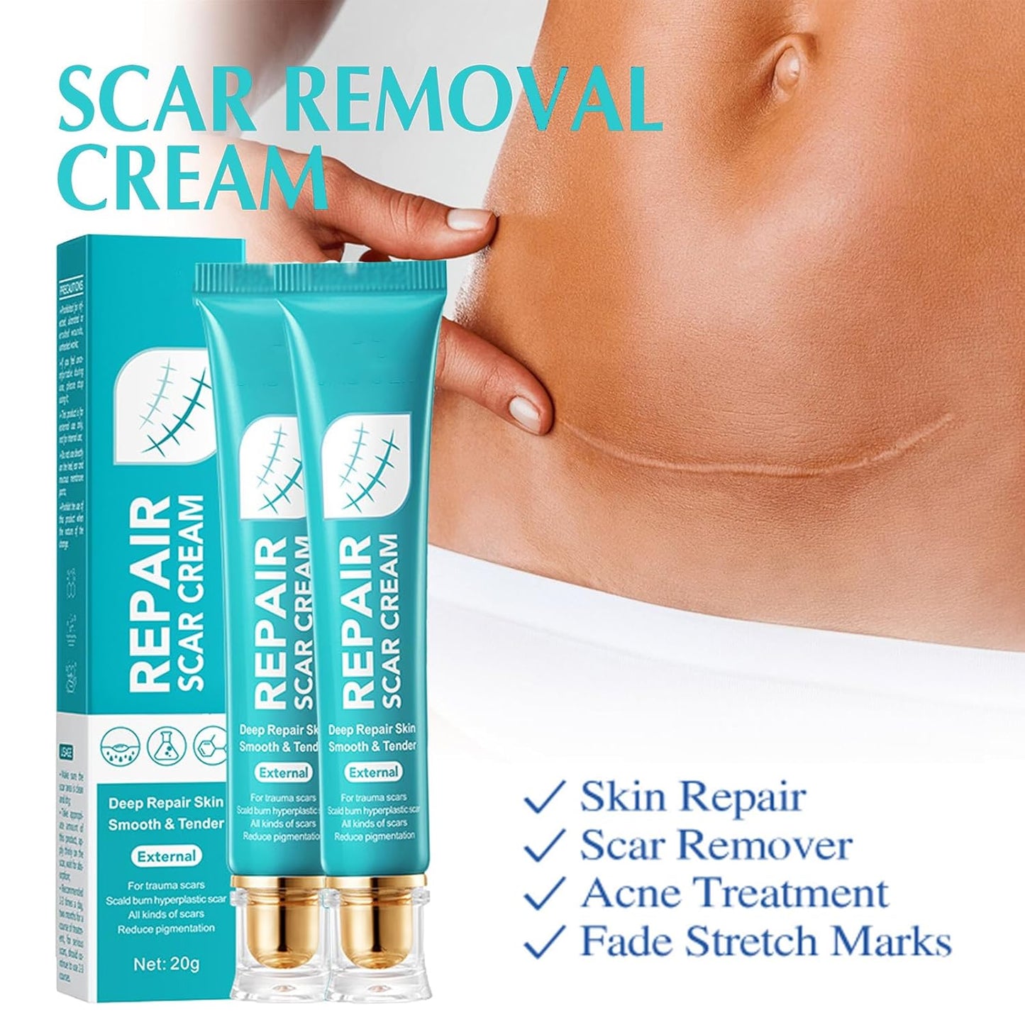 ¡Piel Perfecta! Elimina Cicatrices, Estrías y Marcas con REPAIR SCAR CREAM