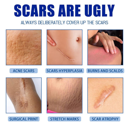 ¡Piel Perfecta! Elimina Cicatrices, Estrías y Marcas con REPAIR SCAR CREAM