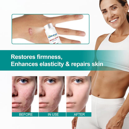 ¡Borra Cicatrices y Marcas para Siempre! Recupera una Piel Lisa y Uniforme sin Cirugías 🚫💉✨